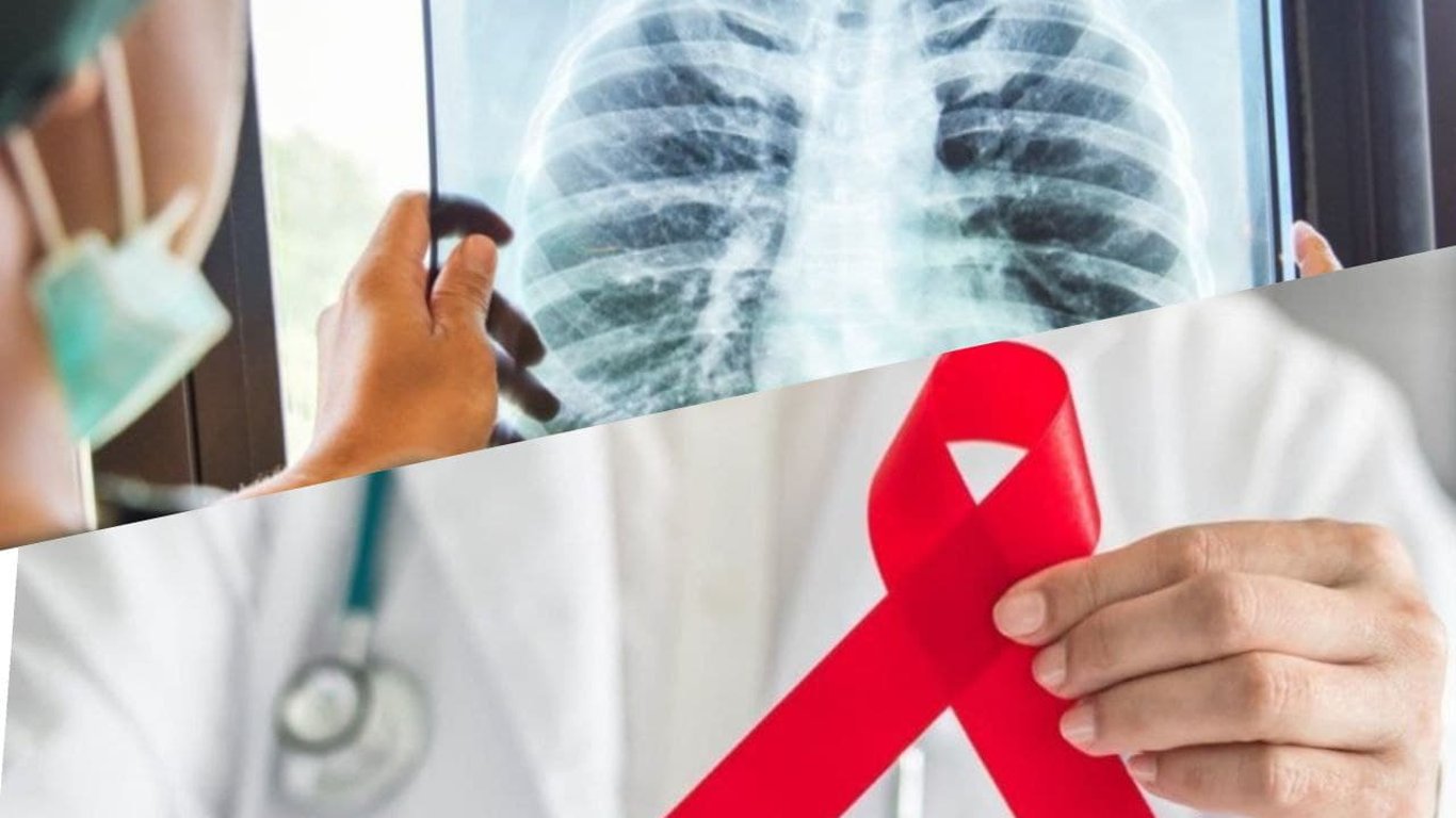 Одещина перша в Україні за кількістю хворих на ВІЛ та туберкульоз