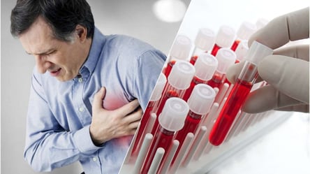 Який взаємозв'язок між ризиком інфаркту і групою крові: дослідження - 285x160