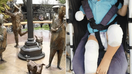 В центрі Одеси маленький хлопчик впав на скульптуру й отримав опіки кінцівок. Фото - 285x160