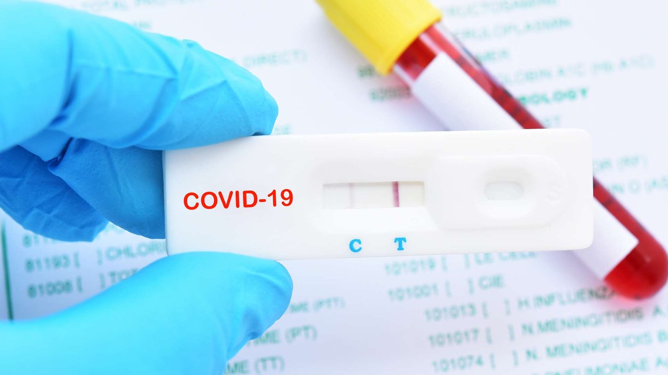 Коронавірус - дані щодо COVID-19 в світі на 26 серпня 2021