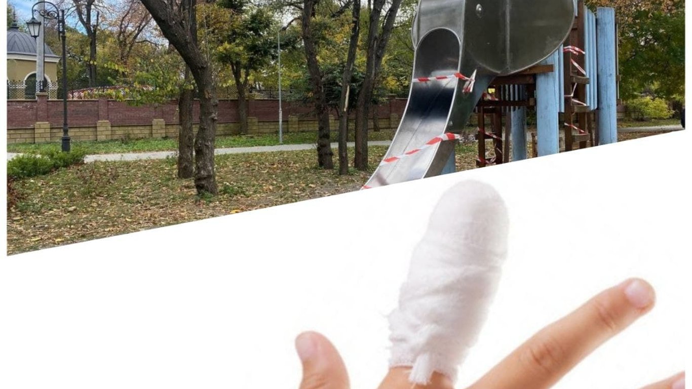 В Одессе ребенку отрезало палец горкой: что известно