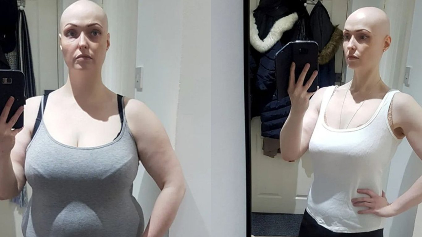 Бросив одну привычку женщина потеряла 36 кг веса