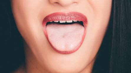 5 слідів на язиці, які попереджають про серйозні проблеми зі здоров'ям - 285x160
