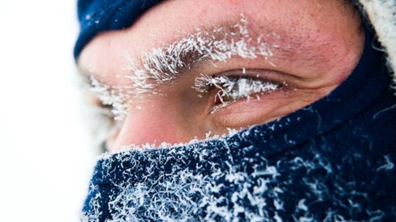 Обморожение во Львове - пьяный мужчина попал в реанимацию с обмороженными руками