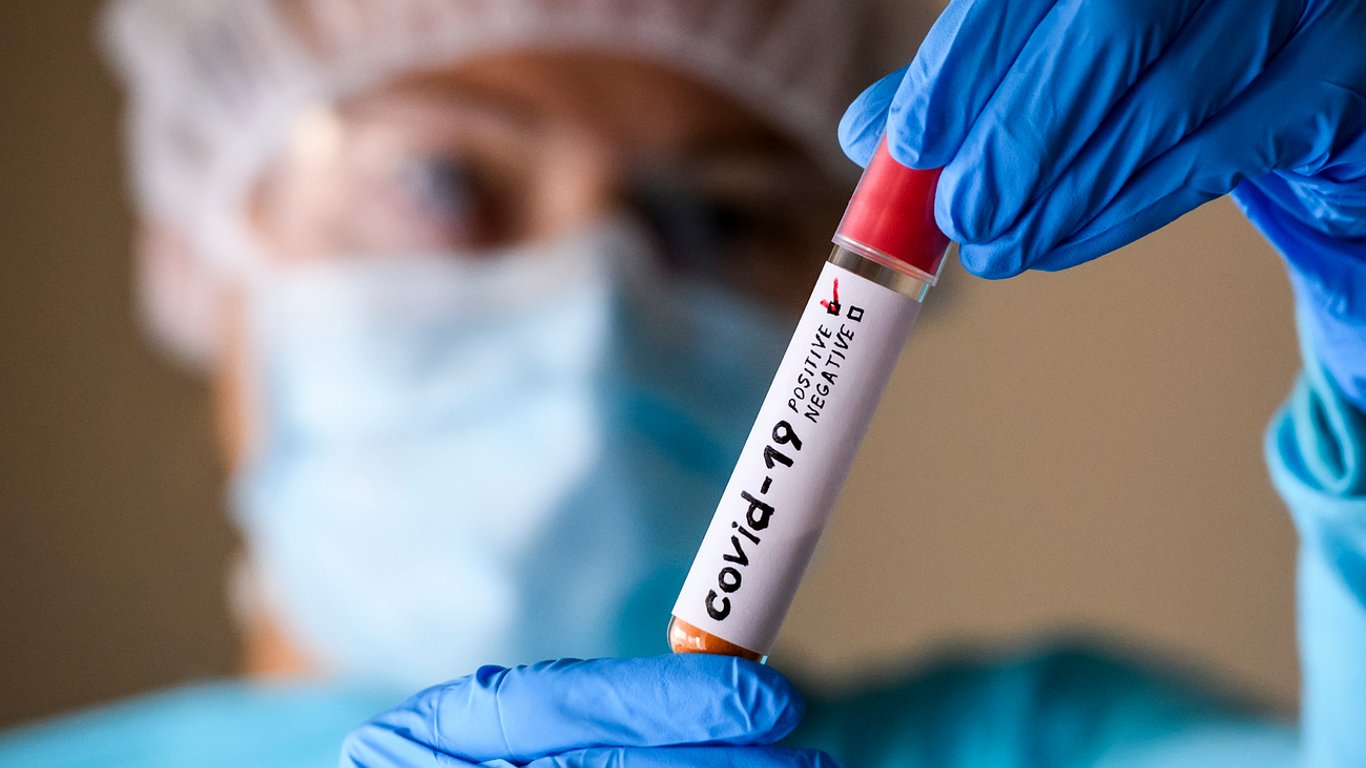 В Україні майже 6 тисяч нових випадків коронавірусу та 278 смертей - дані на 30 грудня