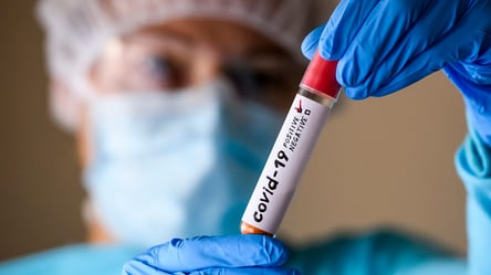 Майже 6 тисяч нових випадків та 278 смертей: дані щодо коронавірусу в Україні на 30 грудня - 285x160