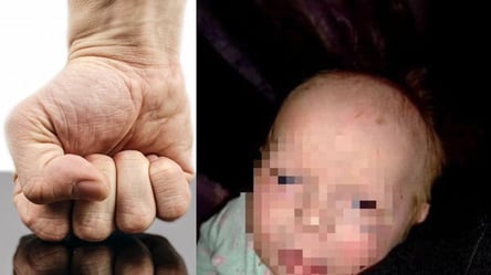 На Вінниччині батько побив 3-місячне немовля: в якому стані дитина - 285x160