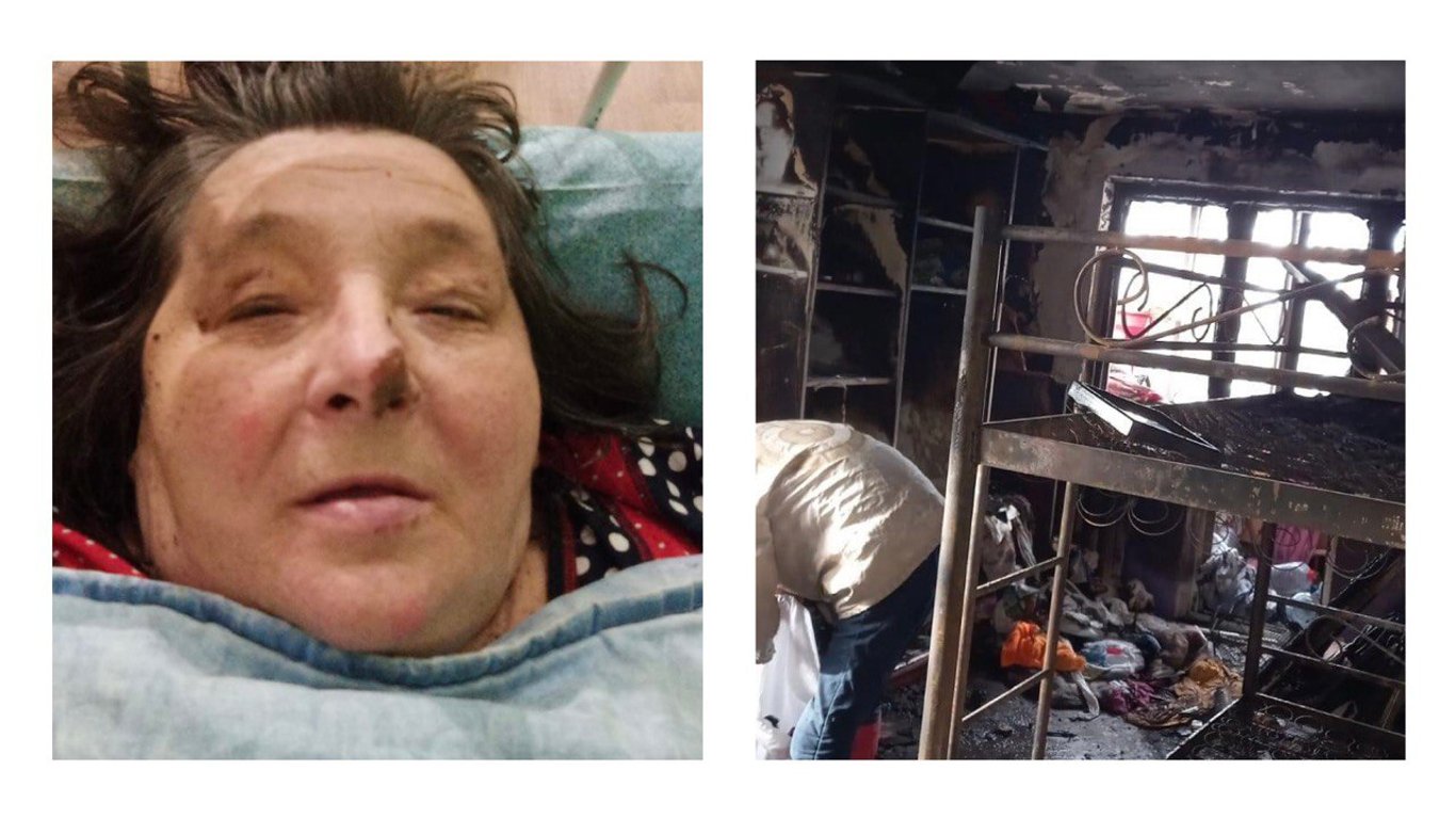 Пожар в Киеве: женщину выгоняют из больницы