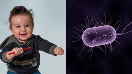 Комаровський перерахував симптоми дуже страшної дитячої хвороби: як розпізнати - 285x160