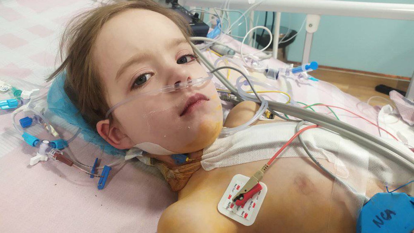 Во Львове провели операцию девочке с пороками сердца-фото