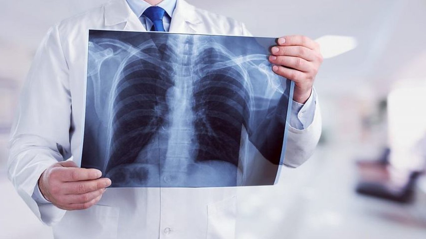 П'ять ознак смертельної хвороби легень