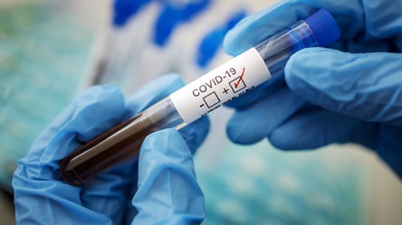 На Харківщині за добу заразилися коронавірусом майже тисяча жителів - 285x160