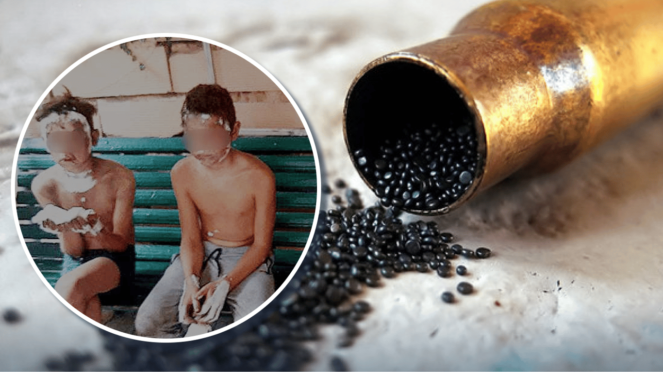 В Одесской области подростки получили ожоги из-за игры с порохом