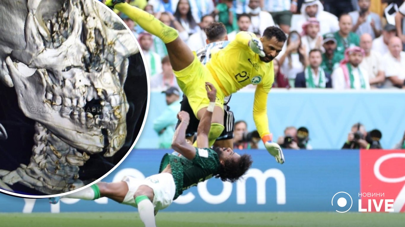 Шокирующая травма в матче Саудовская Аравия — Аргентина