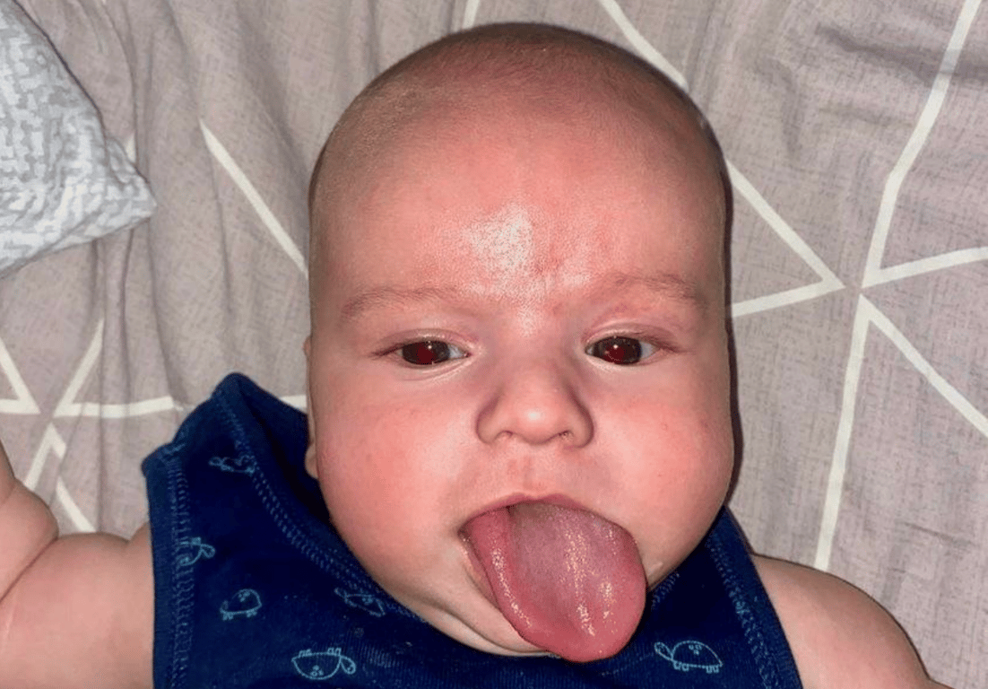 язик у дитини