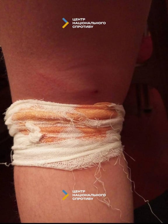 Собаки нападають на людей на ТОТ Луганщини