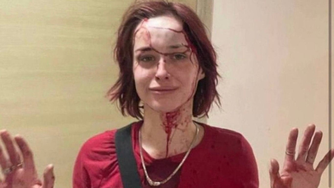 Працівник ТЦК побив дівчину милицею — що вирішив суд