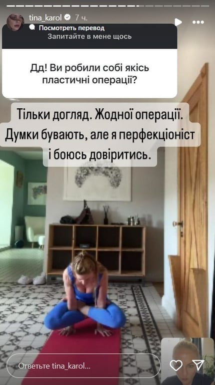 Тіна Кароль вперше зізналась, чи зверталася до пластичних хірургів - фото 1