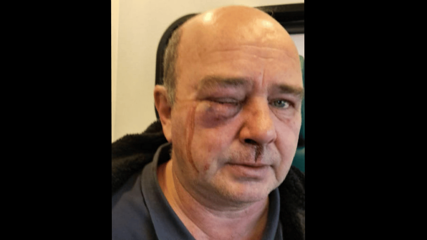 В Киевской области неизвестные избили мужчину во время вручения повестки от ТЦК — соцсети