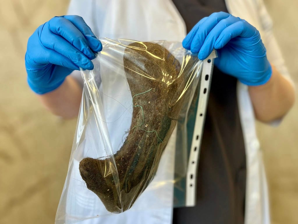 У Києві в дитини зі шлунку дістали камінь з волосся