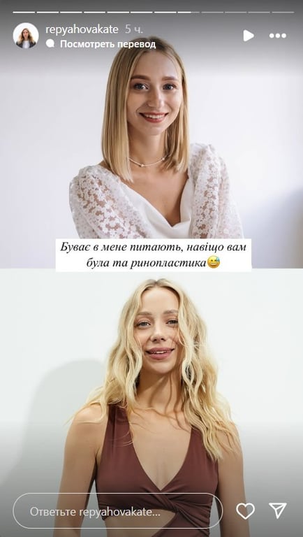 Катерина Павілк про ринопластику 