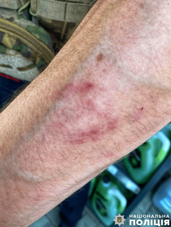 жінка вкусила правоохоронця