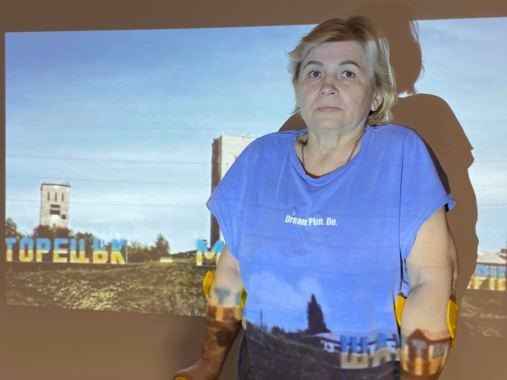 Оленя Мякина після операції. Фото: Перше ТМО Львова 