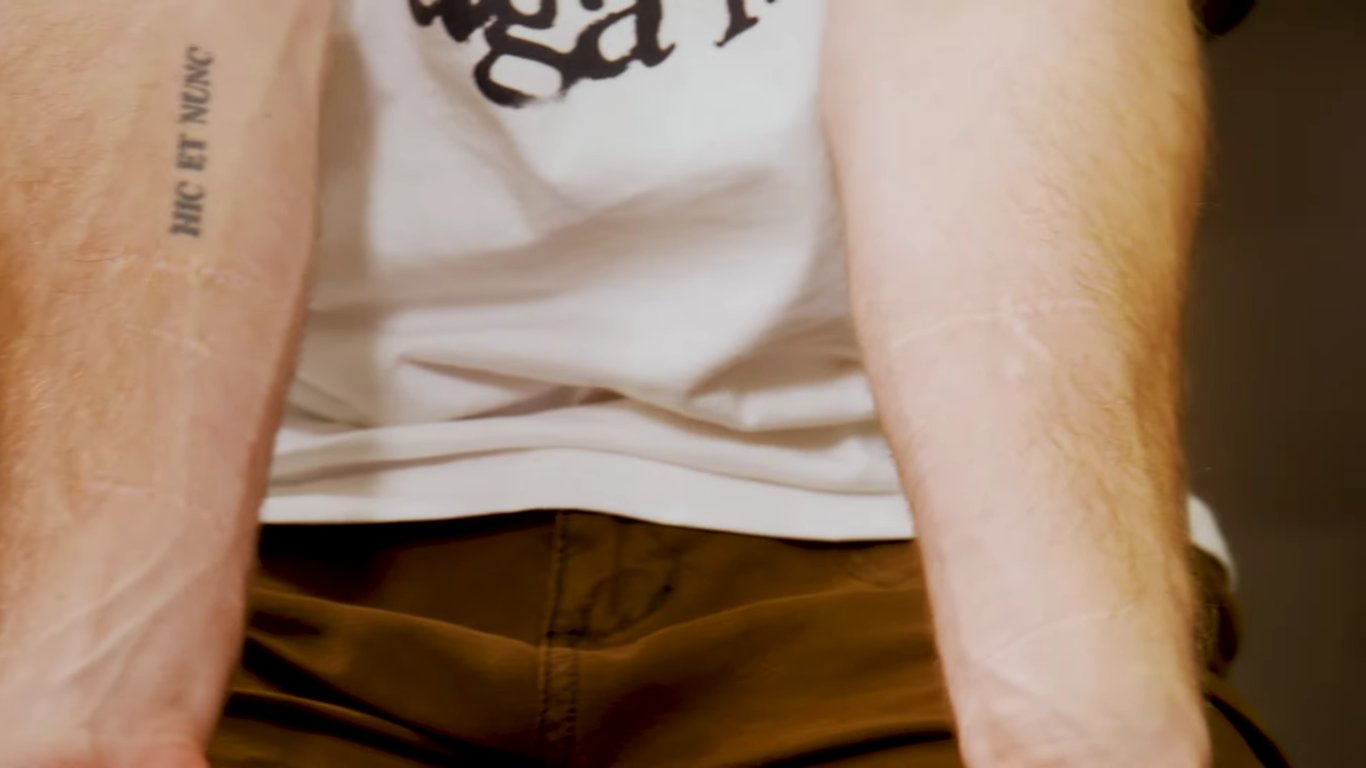 Артур Логай показал шрамы на руках