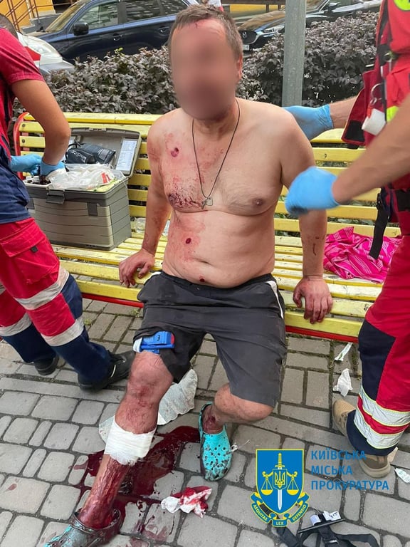 В Киеве водителю, который из пистолета расстрелял охранника парковки, сообщили о подозрении - фото 1