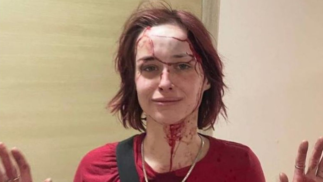 В Одесі працівник ТЦК побив дівчину — в ОК "Південь" відреагували на скандал