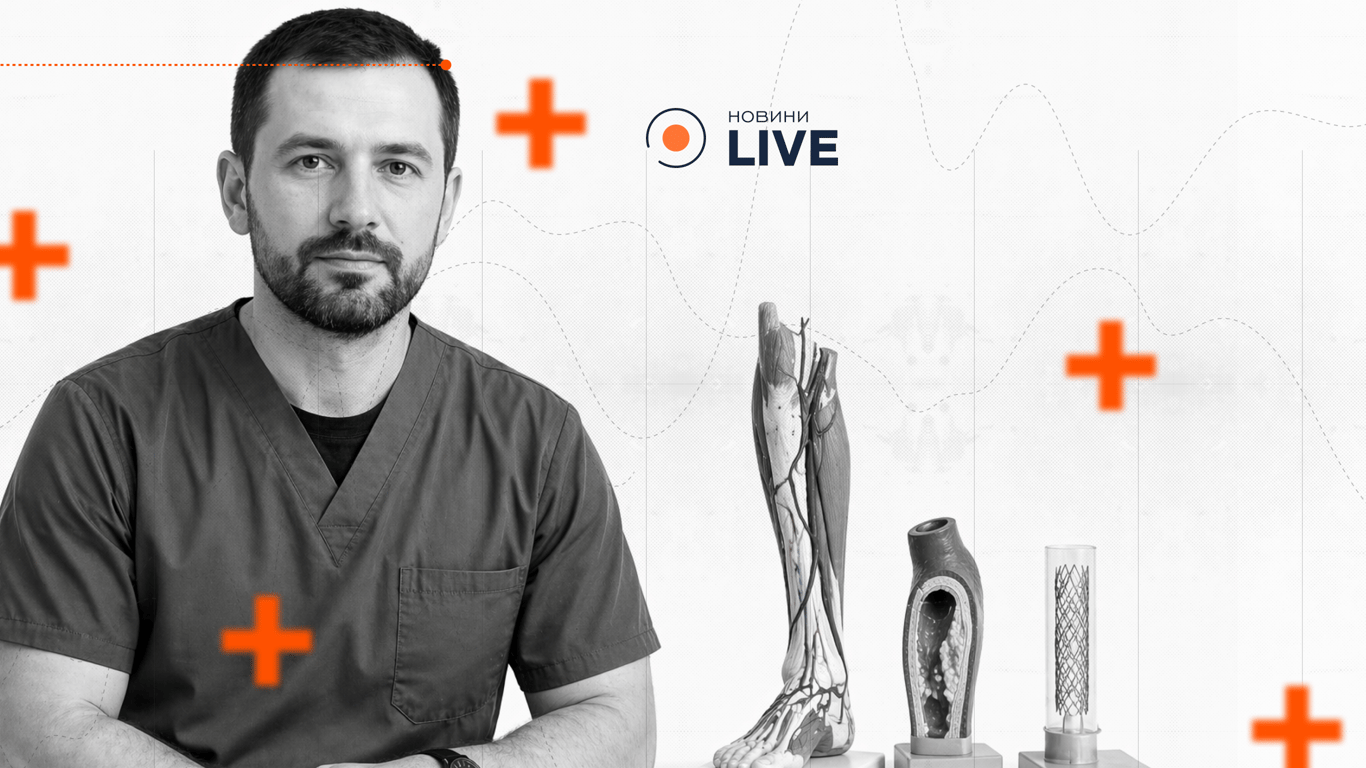 Облітеруючий атеросклероз ніг — як зупинити вчасно. Євген Кислиця — лікар-хірург. Спеціаліст із діабетичної стопи