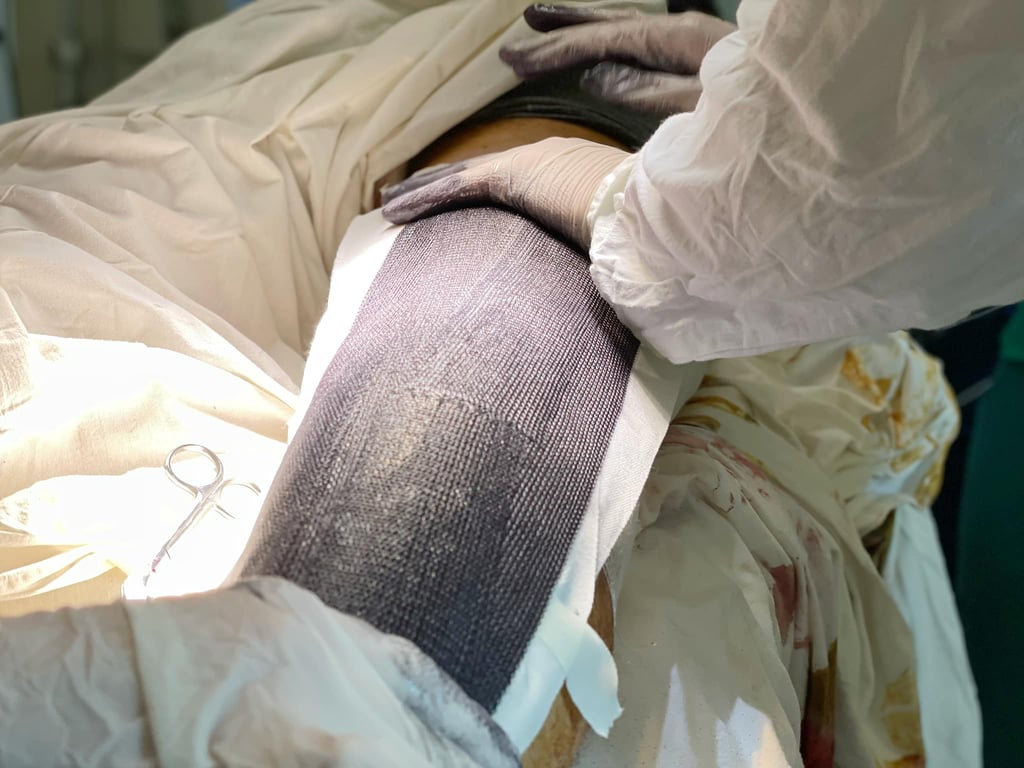 Операція на нозі Кирила. Фото: Перше ТМО