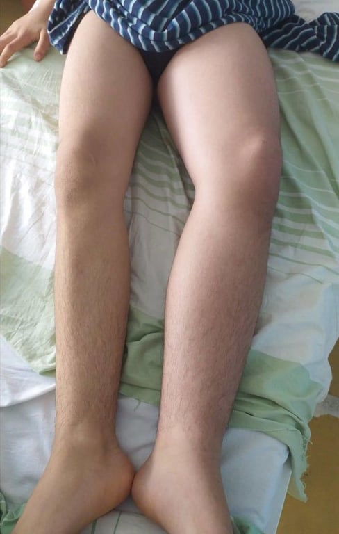 В Киеве жестоко избили 13-летнего школьника, полиция приступила к уголовному производству - фото 1