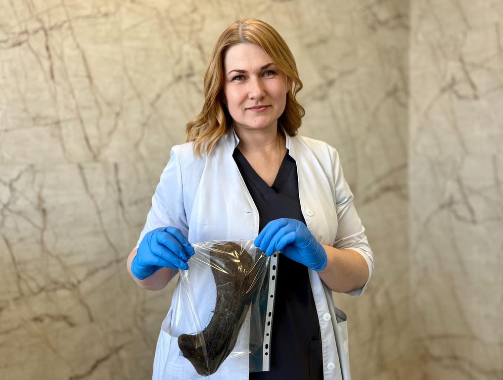 У Києві в дитини зі шлунку дістали камінь з волосся