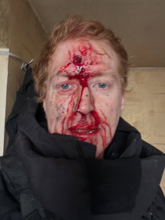 Денис Христов після російського обстрілу