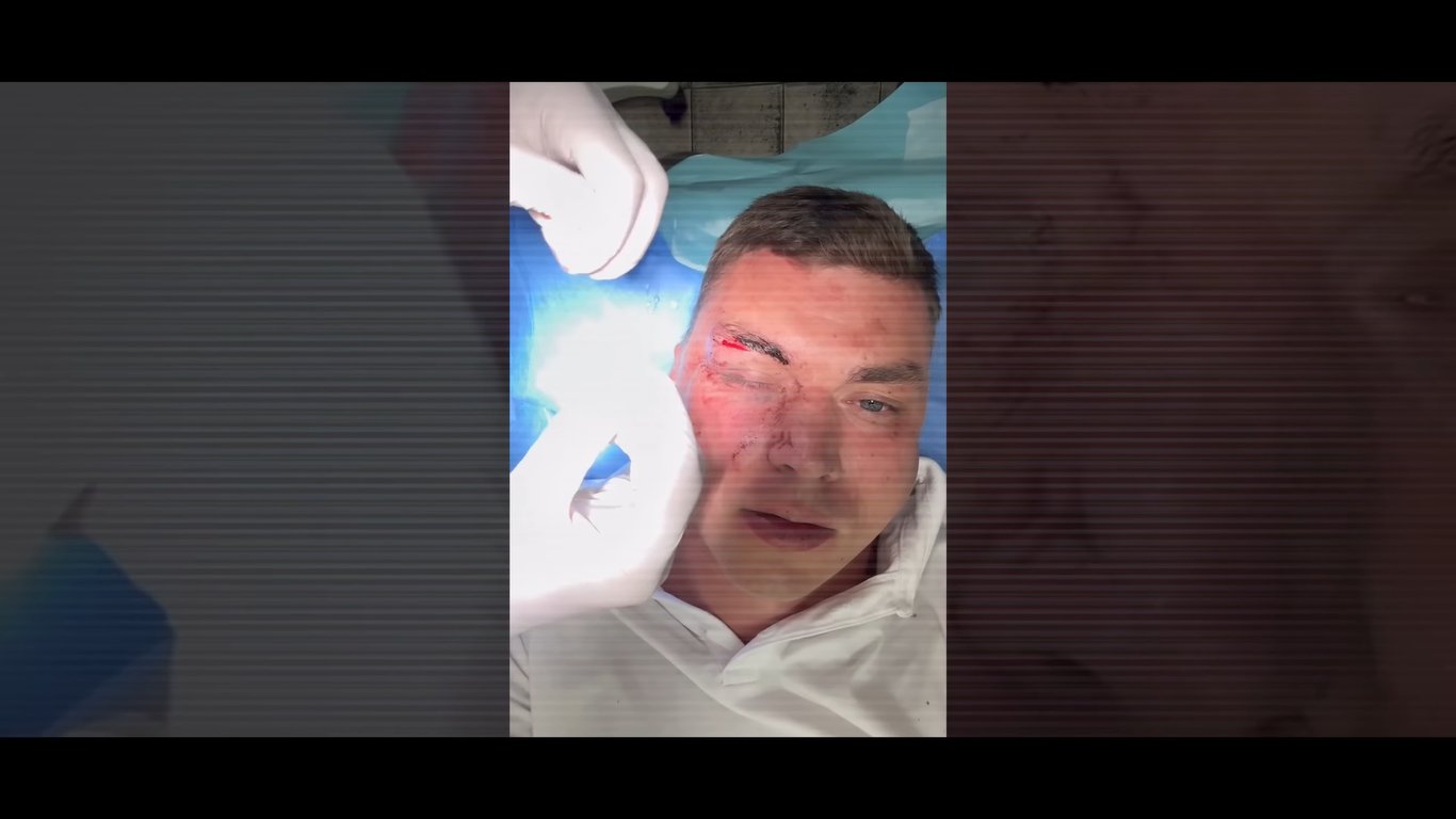 Побитий охоронник Олександра Волошина. Фото: скриншот