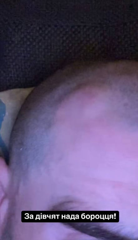 Wellboy серьезно избили - певец показал травмы