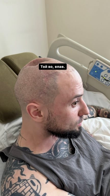 Ранение Виктора Розового на войне. Фото: instagram/viktor_rozovyi