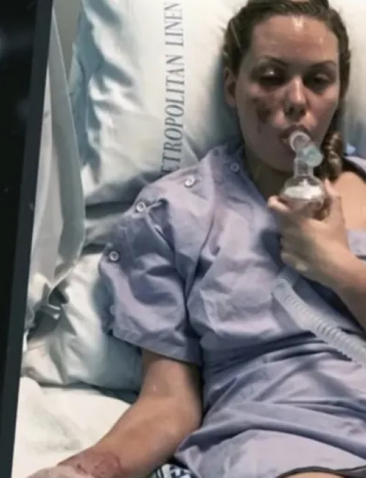 Що сталося з королевою краси Фелісією Джамірзе