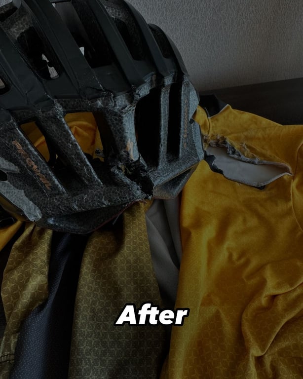 Шеф-повар Гордон Рамзи поделился деталями аварии на велосипеде, в которой серьезно травмировался - фото 2