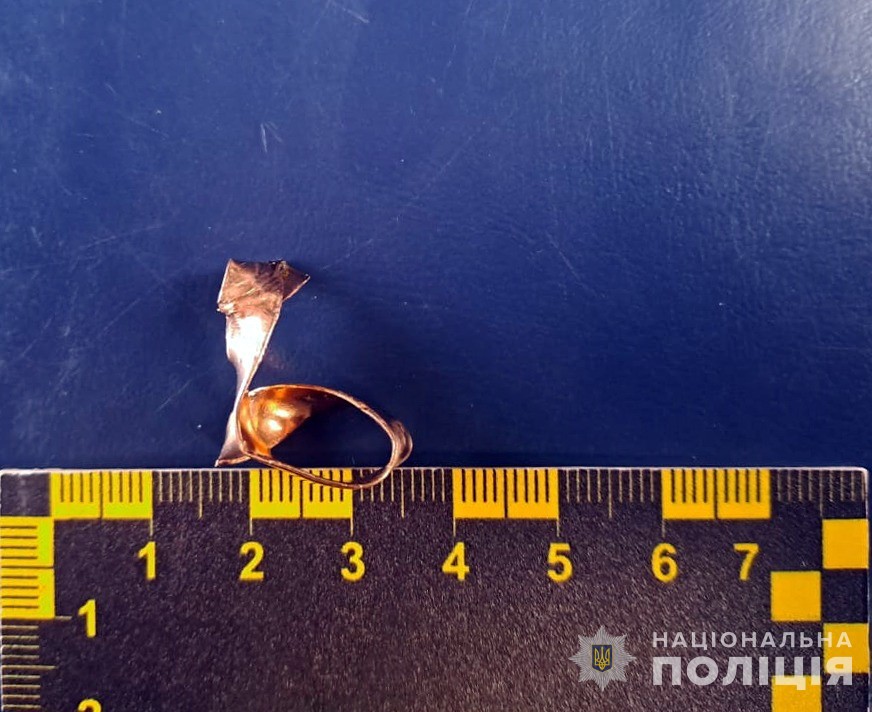 У морзі з руки загиблого героя зрізали обручку