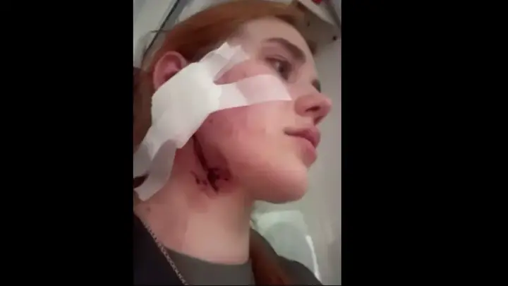 У Польщі побили українську пару через акцент: реакція Генконсульства - фото 1