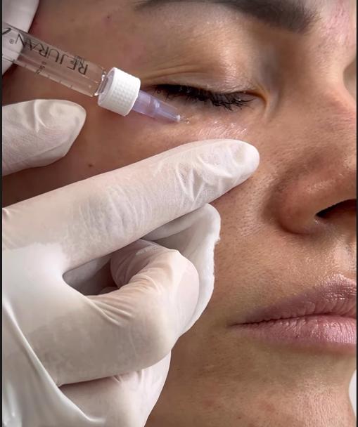 Співачка MamaRika під час процедури. Фото: instagram.com/mamarika_official/