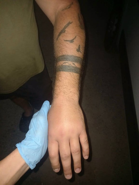 Укус змії на Дніпропетровщині