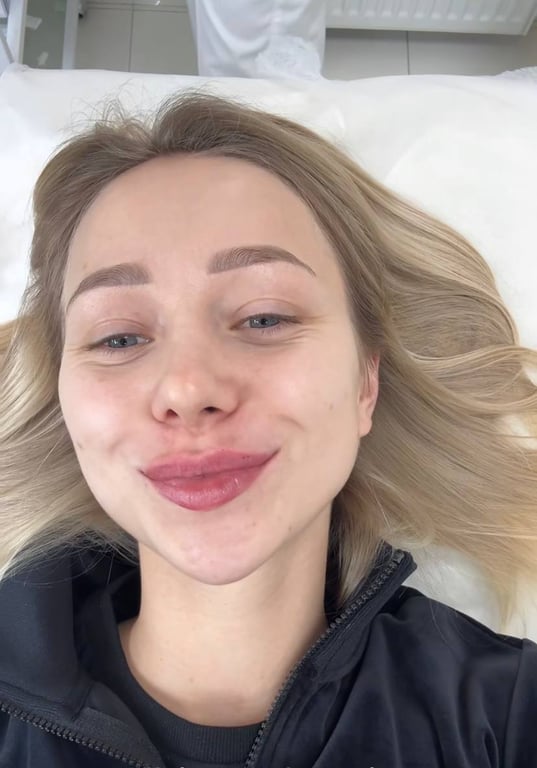 Екатерина Репяхова показала результат уколов красоты