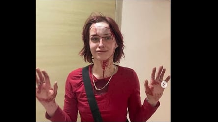 Скандал с избиением одесситки работником ТЦК — что советуют адвокаты девушки - 290x166