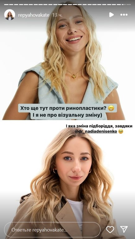 Дружина Віктора Павліка показала результати пластики на обличчі