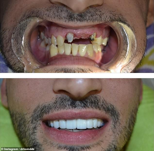 Весил 130 килограммов: как выглядел молодой муж Бритни Спирс до их встречи - фото 4