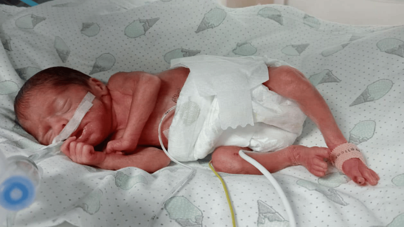 У Львові лікарі врятували життя дівчинці, яка народилась із вагою 600 грамів