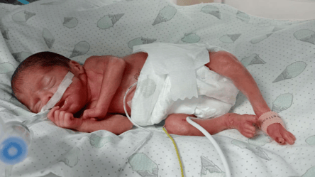 Во Львове врачи спасли жизнь девочке, которая родилась с весом 600 граммов - 285x160
